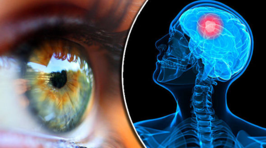 Can an Eye Test Detect a Brain Tumor – Exploring the Connection Between Eye Health and Brain Tumors