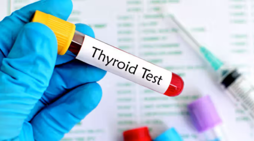 at home thyroid profile test