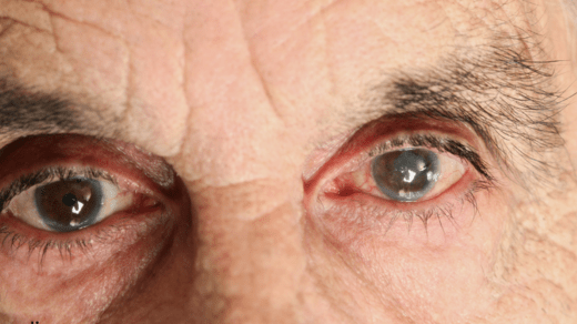 Does high eye pressure always indicate glaucoma?