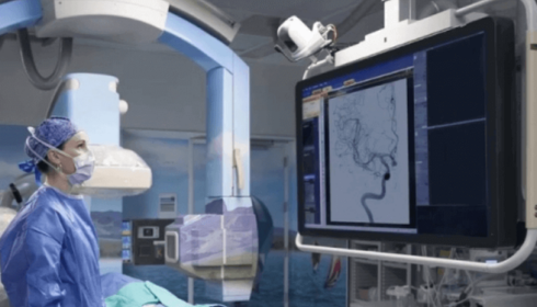 Teleradiology Services: Revolutionizing Remote Diagnostic Imaging