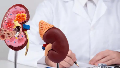 best kidney transplant hospital in Bangalore