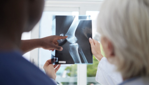 Discovering the Best Orthopaedic Hospital in Bangalore: A Guide to Superior Bone & Joint Care