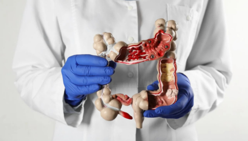 A Guide to the Best Gastroenterology Hospital in Hyderabad