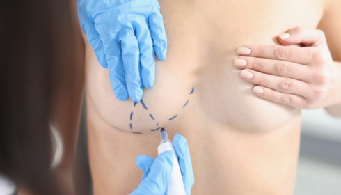 Finding the Right Care: Breast Cancer Treatment Options in India